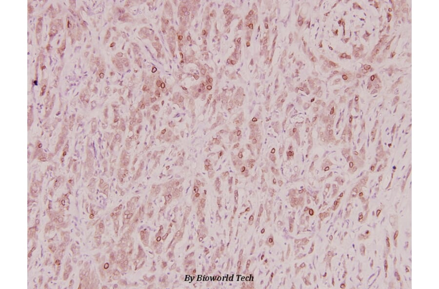Anti-ZNF23 (Q185) Antibody from Bioworld Technology (BS2647) - Antibodies.com