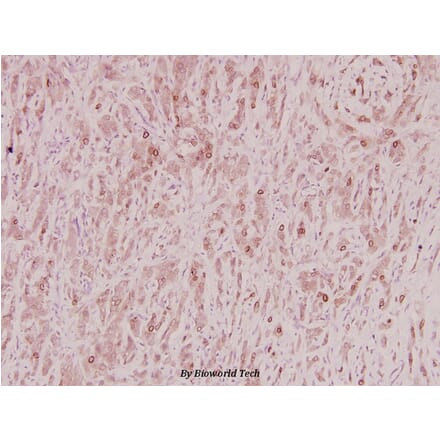 Anti-ZNF23 (Q185) Antibody from Bioworld Technology (BS2647) - Antibodies.com