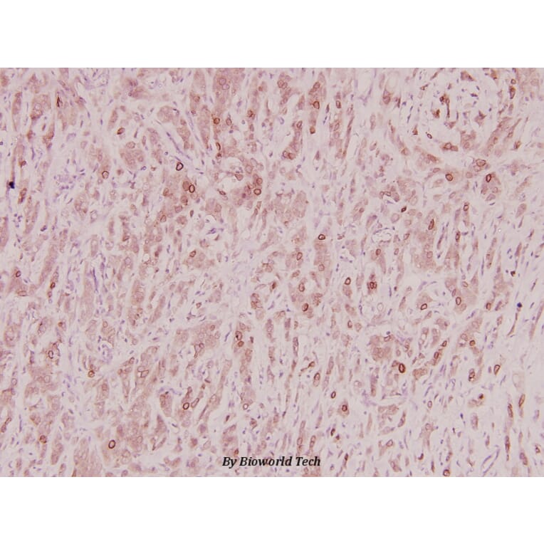Anti-ZNF23 (Q185) Antibody from Bioworld Technology (BS2647) - Antibodies.com