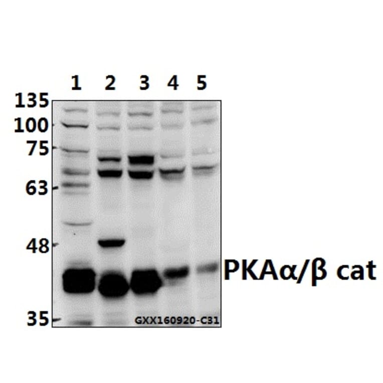 Anti-PKAα/β cat (K17) Antibody from Bioworld Technology (BS2648) - Antibodies.com