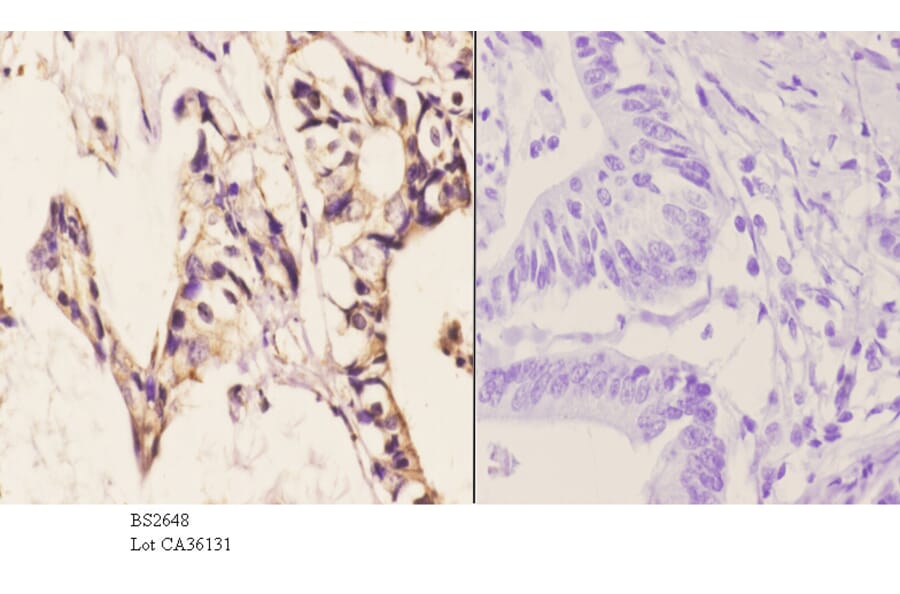 Anti-PKAα/β cat (K17) Antibody from Bioworld Technology (BS2648) - Antibodies.com