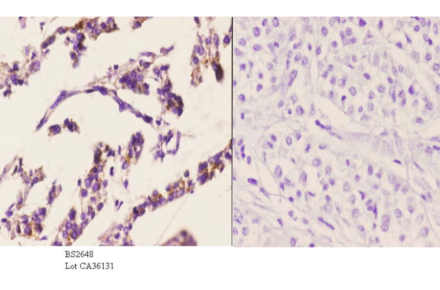Anti-PKAα/β cat (K17) Antibody from Bioworld Technology (BS2648) - Antibodies.com