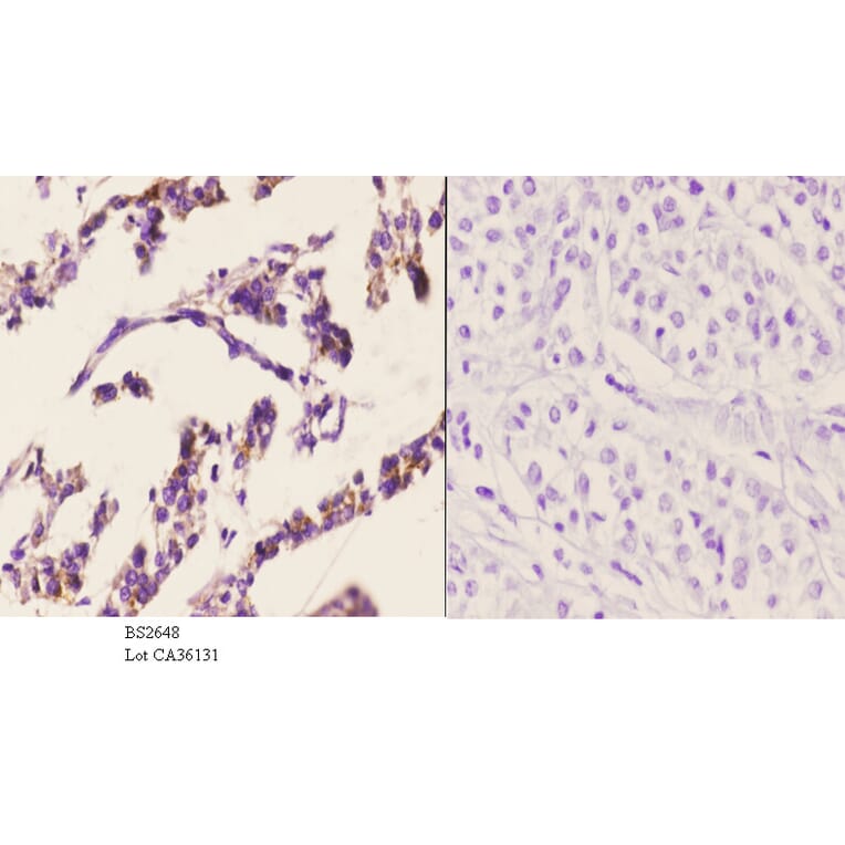 Anti-PKAα/β cat (K17) Antibody from Bioworld Technology (BS2648) - Antibodies.com