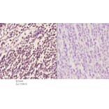 Anti-PU.1 (R212) Antibody from Bioworld Technology (BS2649) - Antibodies.com