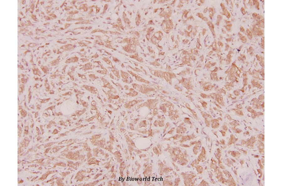 Anti-HoxD12 (E230) Antibody from Bioworld Technology (BS2651) - Antibodies.com