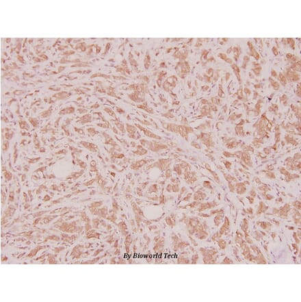 Anti-HoxD12 (E230) Antibody from Bioworld Technology (BS2651) - Antibodies.com