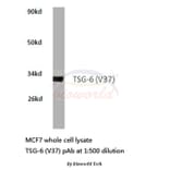 Anti-TSG-6 (V37) Antibody from Bioworld Technology (BS2655) - Antibodies.com