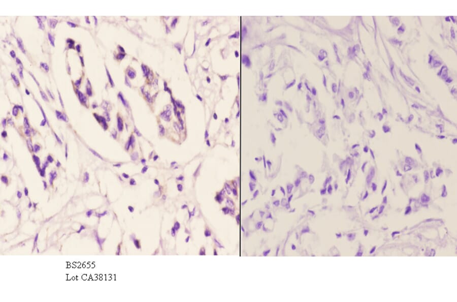 Anti-TSG-6 (V37) Antibody from Bioworld Technology (BS2655) - Antibodies.com