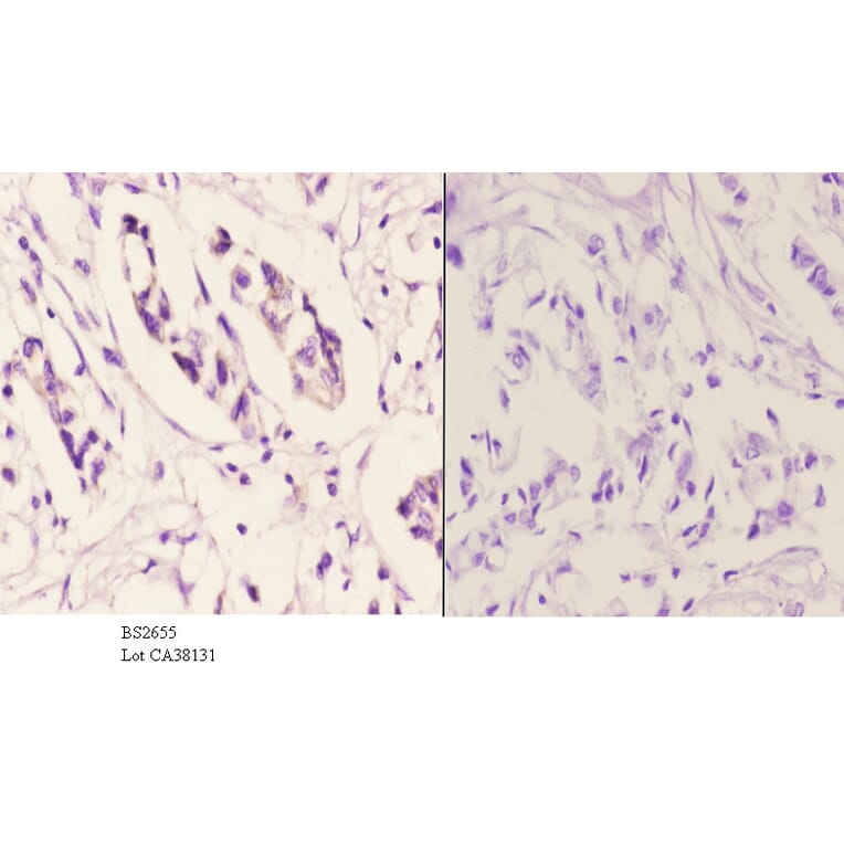 Anti-TSG-6 (V37) Antibody from Bioworld Technology (BS2655) - Antibodies.com
