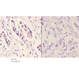 Anti-TSG-6 (V37) Antibody from Bioworld Technology (BS2655) - Antibodies.com