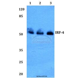 Anti-IRF-4 (Y294) Antibody from Bioworld Technology (BS2659) - Antibodies.com
