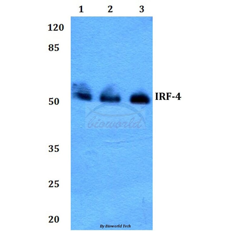 Anti-IRF-4 (Y294) Antibody from Bioworld Technology (BS2659) - Antibodies.com