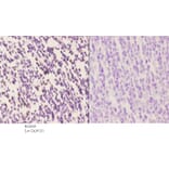 Anti-IRF-4 (Y294) Antibody from Bioworld Technology (BS2659) - Antibodies.com