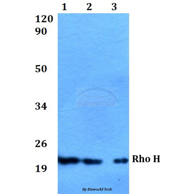 Anti-Rho H (M134) Antibody from Bioworld Technology (BS2660) - Antibodies.com