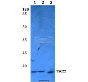 Anti-TSC22 (E73) Antibody from Bioworld Technology (BS2661) - Antibodies.com