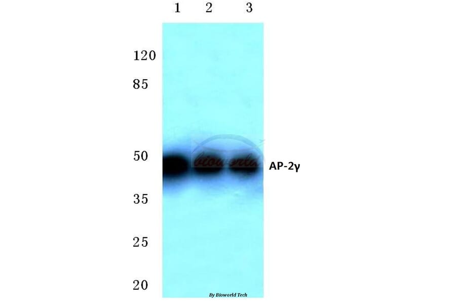 Anti-AP-2γ (A436) Antibody from Bioworld Technology (BS2667) - Antibodies.com