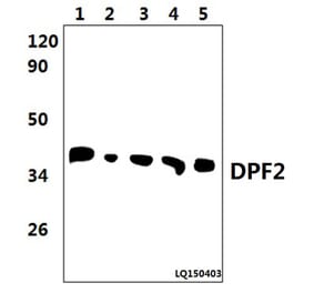Anti-DPF2 (E174) Antibody from Bioworld Technology (BS2668) - Antibodies.com