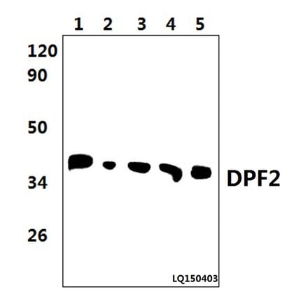 Anti-DPF2 (E174) Antibody from Bioworld Technology (BS2668) - Antibodies.com