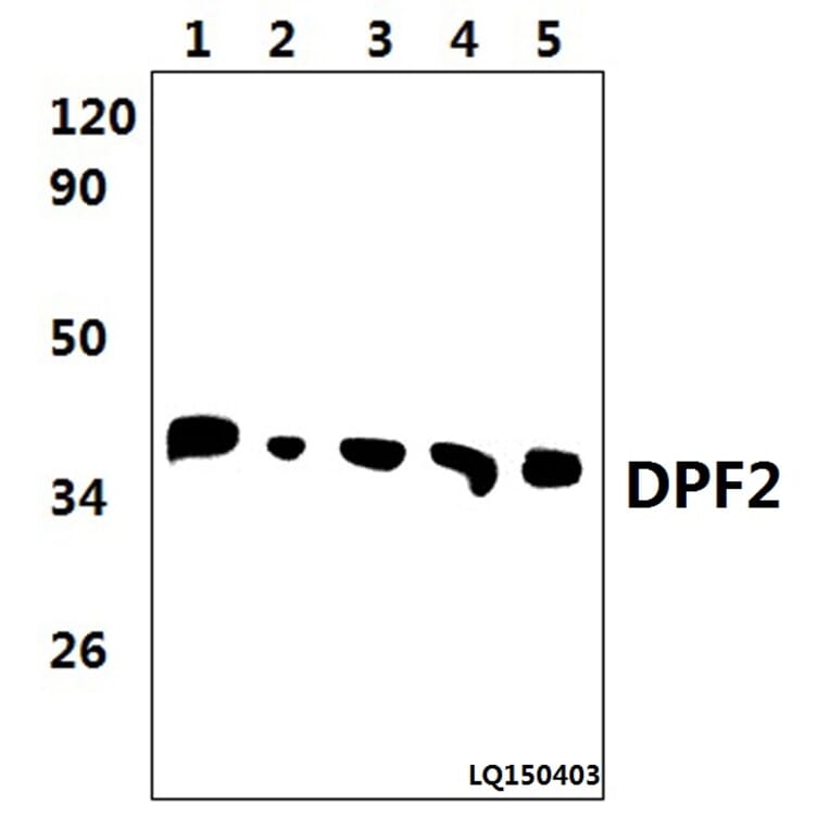 Anti-DPF2 (E174) Antibody from Bioworld Technology (BS2668) - Antibodies.com