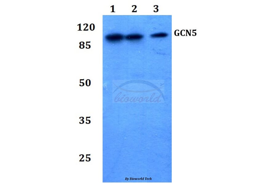 Anti-GCN5 (G720) Antibody from Bioworld Technology (BS2669) - Antibodies.com