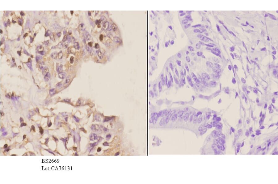 Anti-GCN5 (G720) Antibody from Bioworld Technology (BS2669) - Antibodies.com