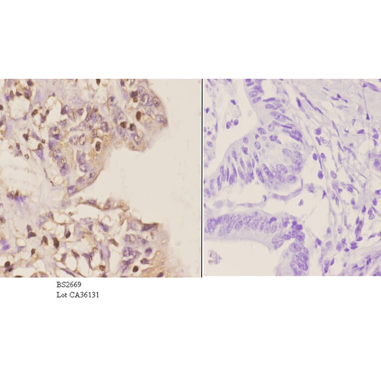 Anti-GCN5 (G720) Antibody from Bioworld Technology (BS2669) - Antibodies.com