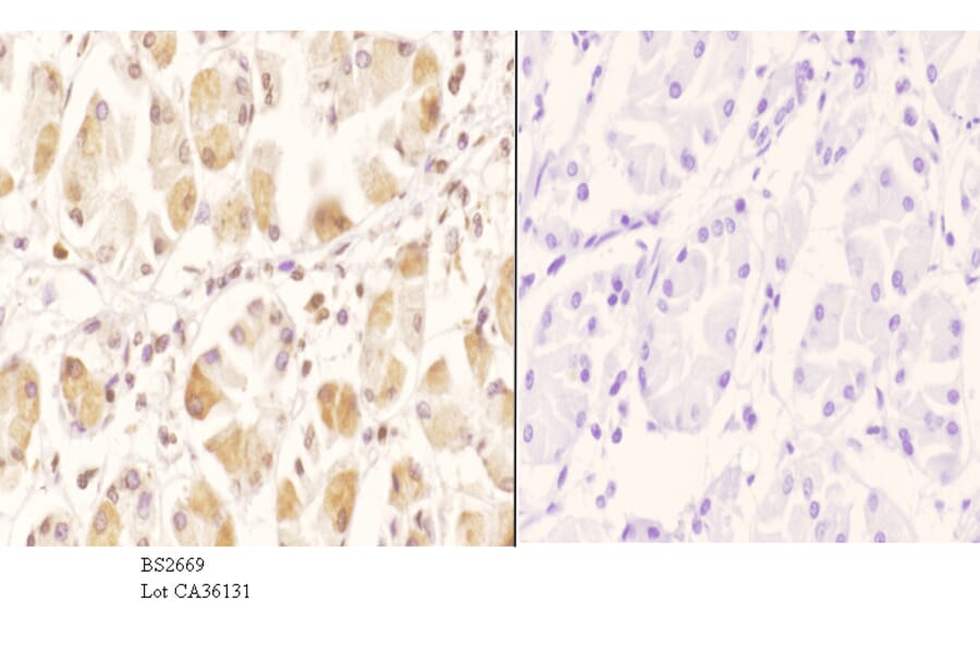 Anti-GCN5 (G720) Antibody from Bioworld Technology (BS2669) - Antibodies.com