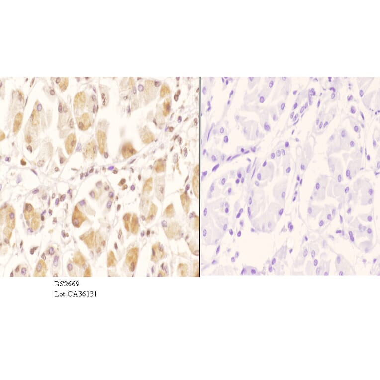Anti-GCN5 (G720) Antibody from Bioworld Technology (BS2669) - Antibodies.com