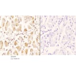 Anti-GCN5 (G720) Antibody from Bioworld Technology (BS2669) - Antibodies.com