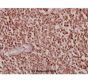 Anti-Dyrk1B (T356) Antibody from Bioworld Technology (BS2677) - Antibodies.com