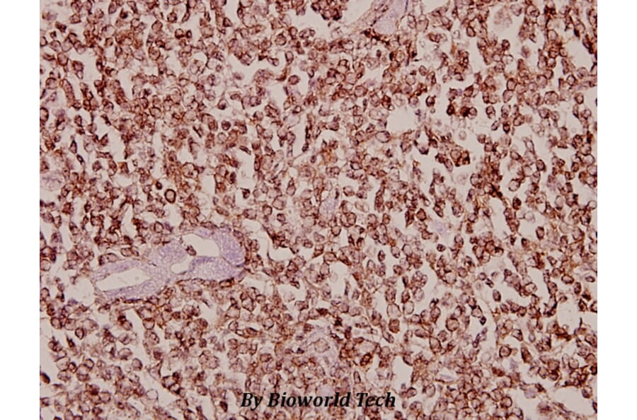 Anti-Dyrk1B (T356) Antibody from Bioworld Technology (BS2677) - Antibodies.com