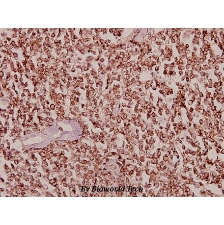 Anti-Dyrk1B (T356) Antibody from Bioworld Technology (BS2677) - Antibodies.com