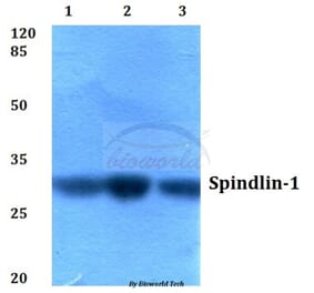 Anti-Spindlin-1 (H139) Antibody from Bioworld Technology (BS2678) - Antibodies.com
