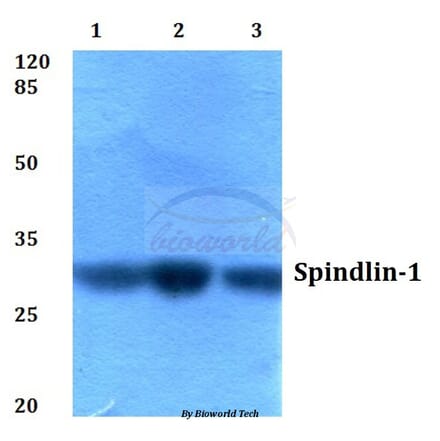 Anti-Spindlin-1 (H139) Antibody from Bioworld Technology (BS2678) - Antibodies.com