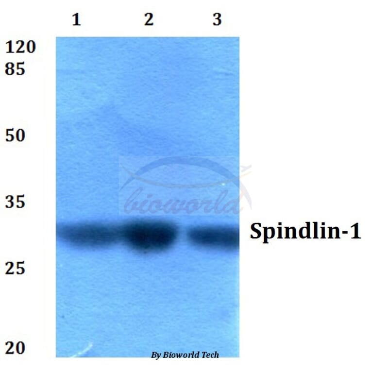 Anti-Spindlin-1 (H139) Antibody from Bioworld Technology (BS2678) - Antibodies.com