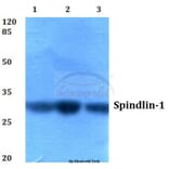 Anti-Spindlin-1 (H139) Antibody from Bioworld Technology (BS2678) - Antibodies.com