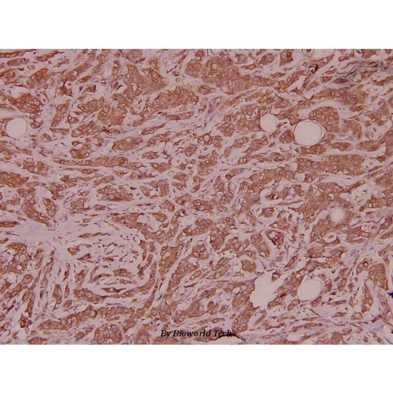 Anti-Spindlin-1 (H139) Antibody from Bioworld Technology (BS2678) - Antibodies.com