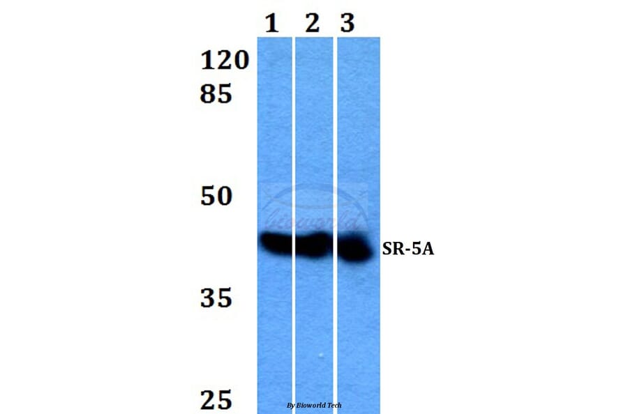 Anti-SR-5A (P241) Antibody from Bioworld Technology (BS2680) - Antibodies.com