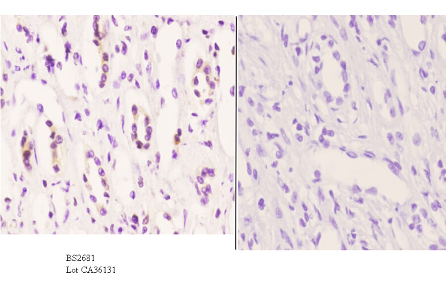 Anti-CYP2D6 (A277) Antibody from Bioworld Technology (BS2681) - Antibodies.com