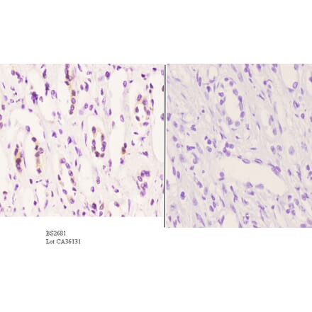 Anti-CYP2D6 (A277) Antibody from Bioworld Technology (BS2681) - Antibodies.com