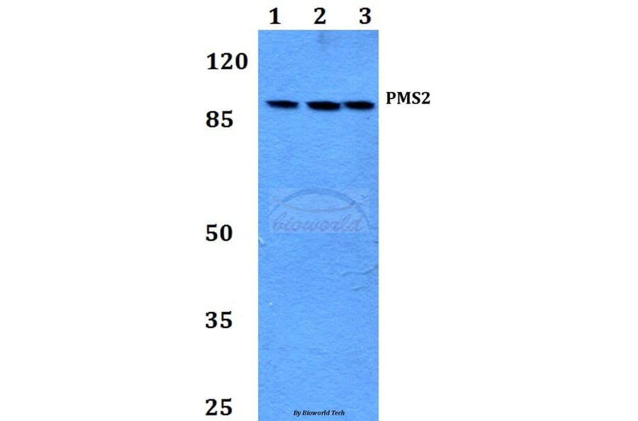 Anti-PMS2 (D483) Antibody from Bioworld Technology (BS2688) - Antibodies.com