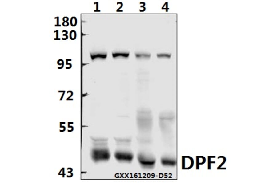Anti-PMS2 (D483) Antibody from Bioworld Technology (BS2688) - Antibodies.com