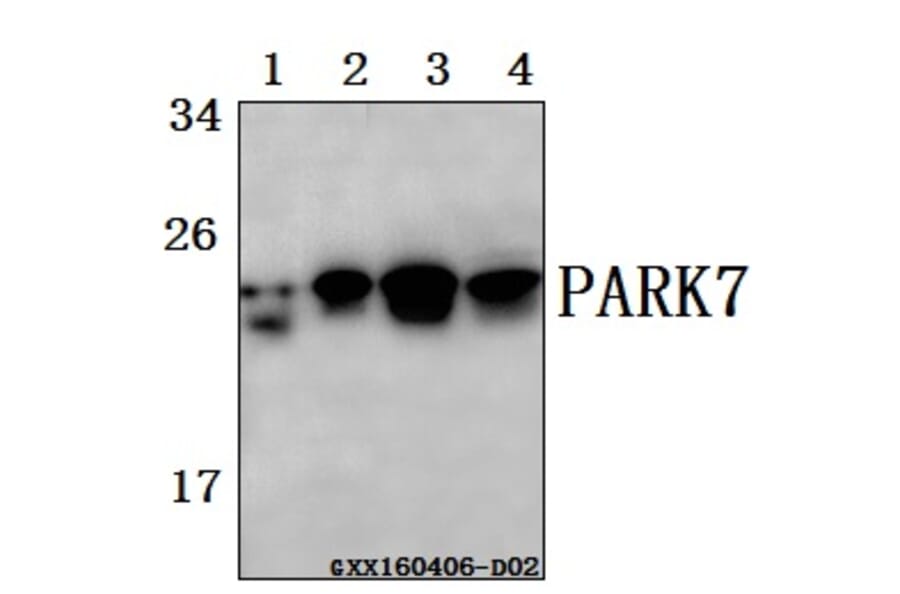Anti-PARK7 (A87) Antibody from Bioworld Technology (BS2690) - Antibodies.com