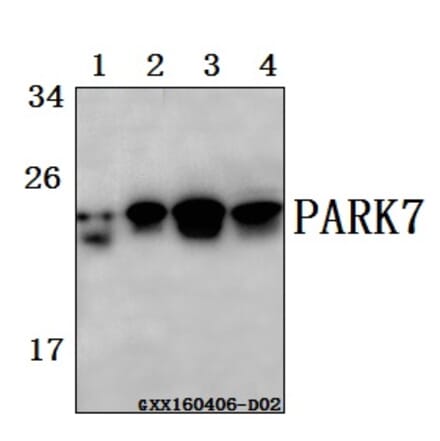 Anti-PARK7 (A87) Antibody from Bioworld Technology (BS2690) - Antibodies.com