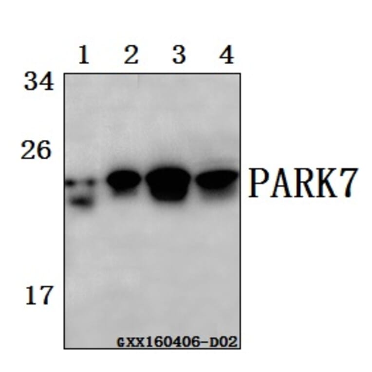 Anti-PARK7 (A87) Antibody from Bioworld Technology (BS2690) - Antibodies.com