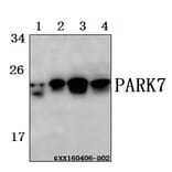 Anti-PARK7 (A87) Antibody from Bioworld Technology (BS2690) - Antibodies.com