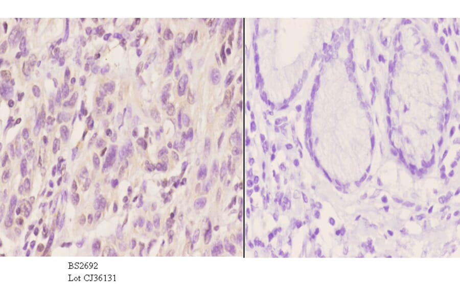 Anti-XRCC5 (S462) Antibody from Bioworld Technology (BS2692) - Antibodies.com