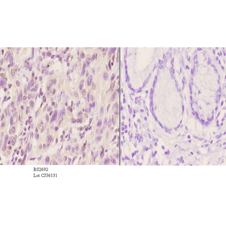 Anti-XRCC5 (S462) Antibody from Bioworld Technology (BS2692) - Antibodies.com