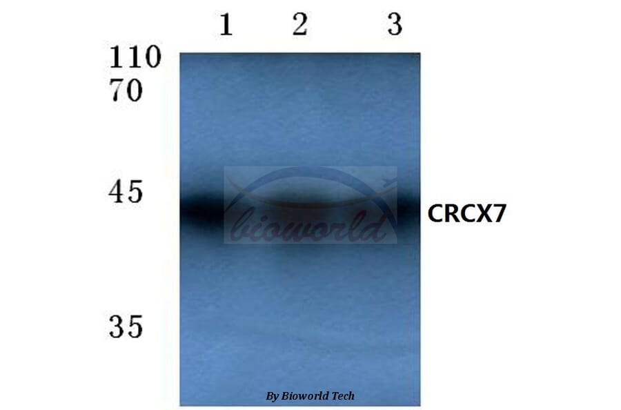 Anti-CXCR7 (A356) Antibody from Bioworld Technology (BS2694) - Antibodies.com