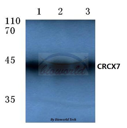 Anti-CXCR7 (A356) Antibody from Bioworld Technology (BS2694) - Antibodies.com